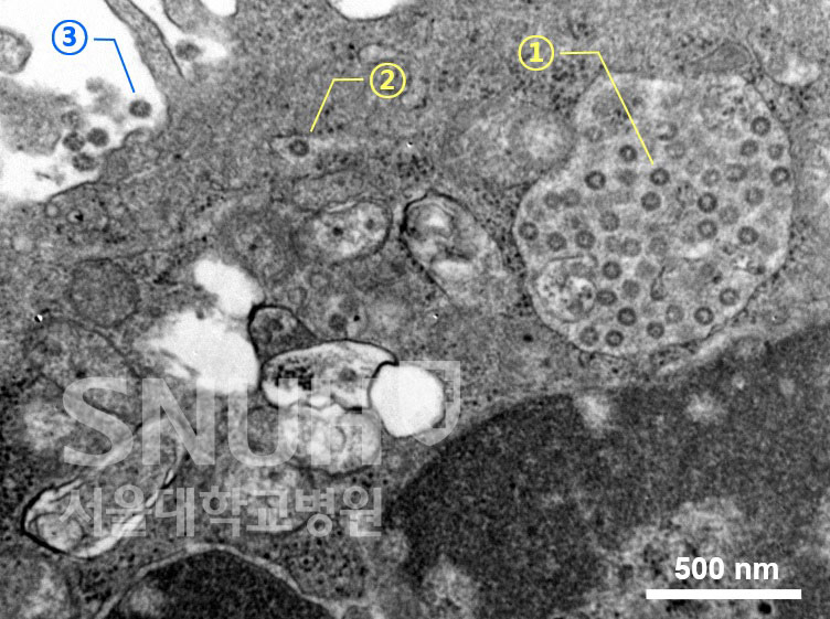 “코로나19,인류 최대 70% 감염가능”…신종 계절병 질환 될 수도