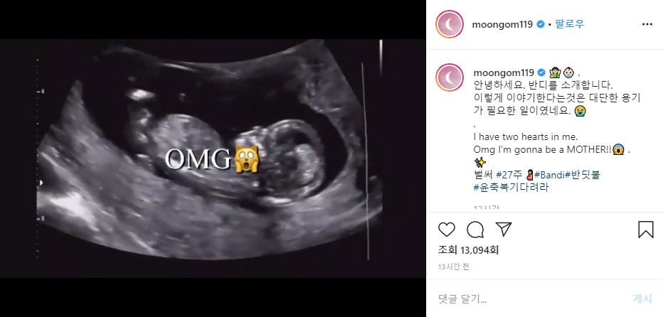 문현아가 자신의 인스타그램에 올린 초음파 영상. [문현아 인스타그램]