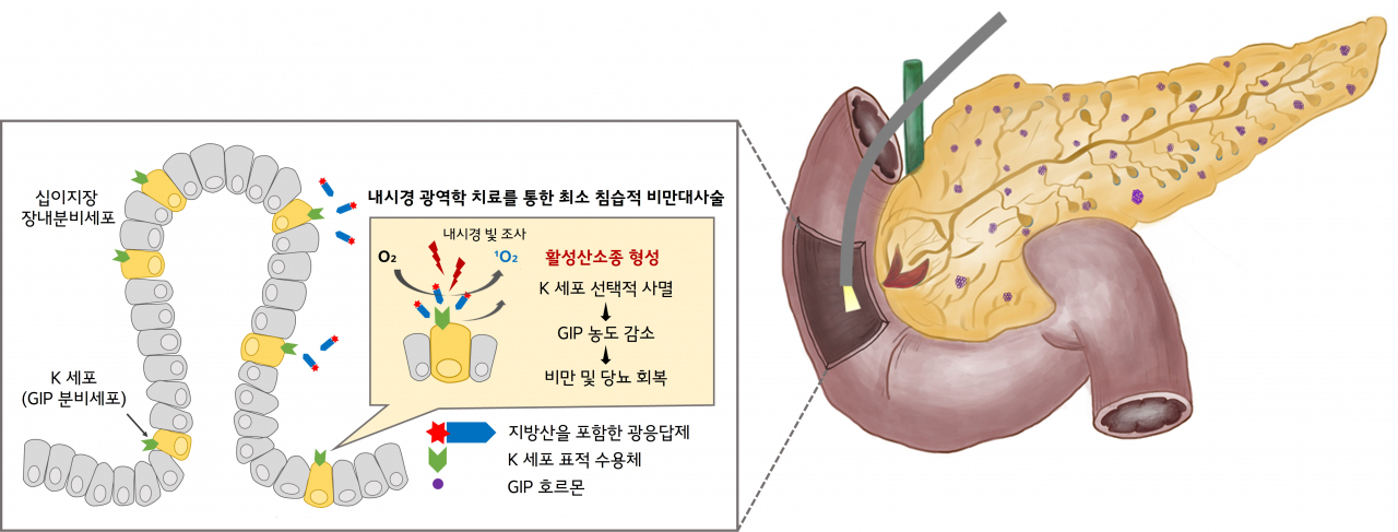지방산-광응답제 접합제를 이용한 비만 대사성 질환 광역학 치료 개념도.[한국연구재단 제공]
