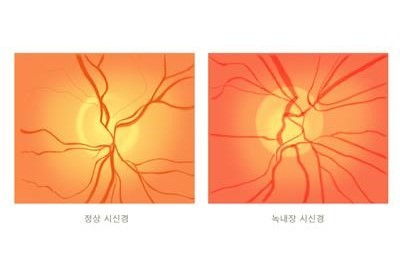 (삼성서울병원-연합뉴스)
