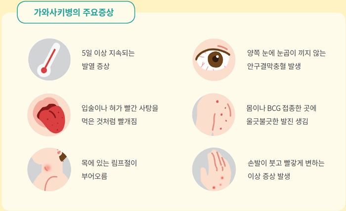가와사키병의 주요증상〈가톨릭대학교 인천성모병원 제공〉