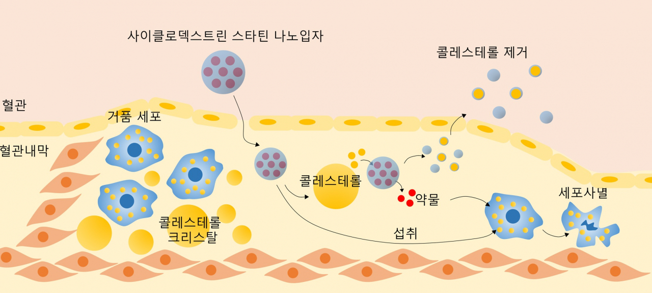 사이클로덱스트린-스타틴 나노입자의 시너지 치료 효과를 보여주는 모식도.[KAIST 제공]