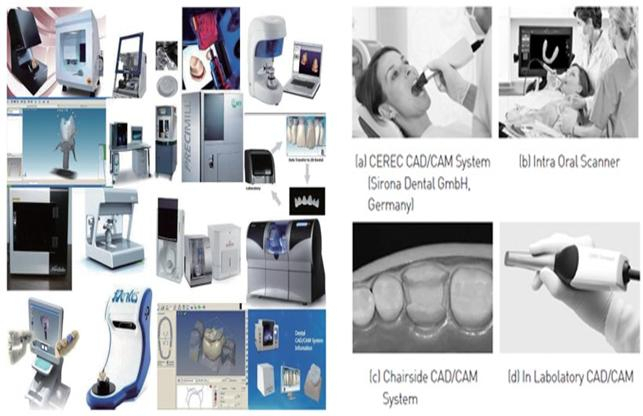 상용화된 치과용 CAD/CAM 시스템 및 3D구상 스캐너