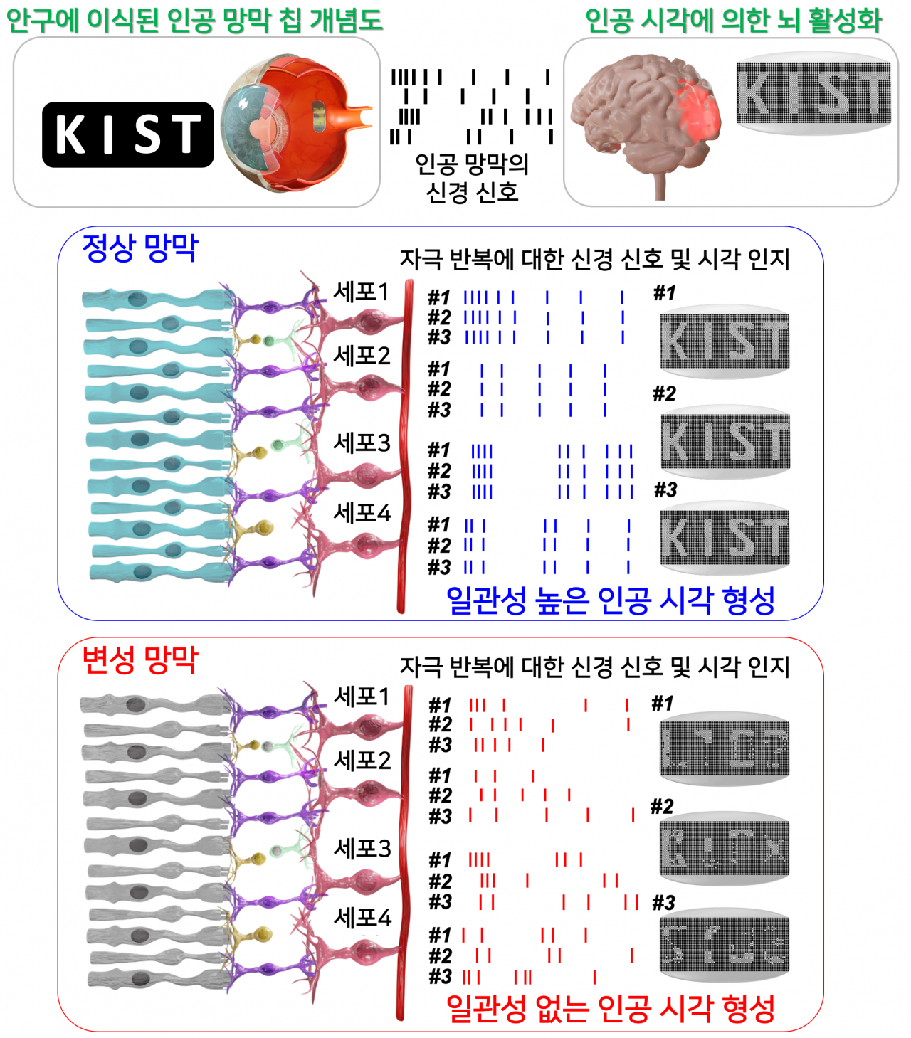 정상 망막은 반복적 전기 자극에 대해 비슷한 신경신호를 뇌로 전달해 시각정보를 사용자가 정확하게 인지할 수 있다. 변성 망막에서는 동일 전기 자극에도 서로 다른 신경신호가 뇌로 전달돼 시각정보를 정확하게 인지하지 못한다.[KIST 제공]