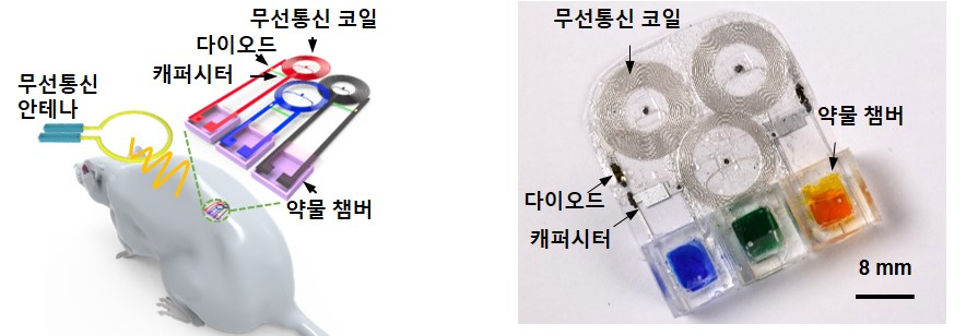 쥐 모델에 적용된 생분해성 무선 멀티약물전달 의료기기 삽입 모식도.[고려대학교 제공]