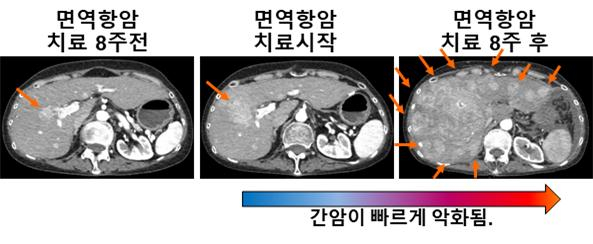 [분당차병원 제공]