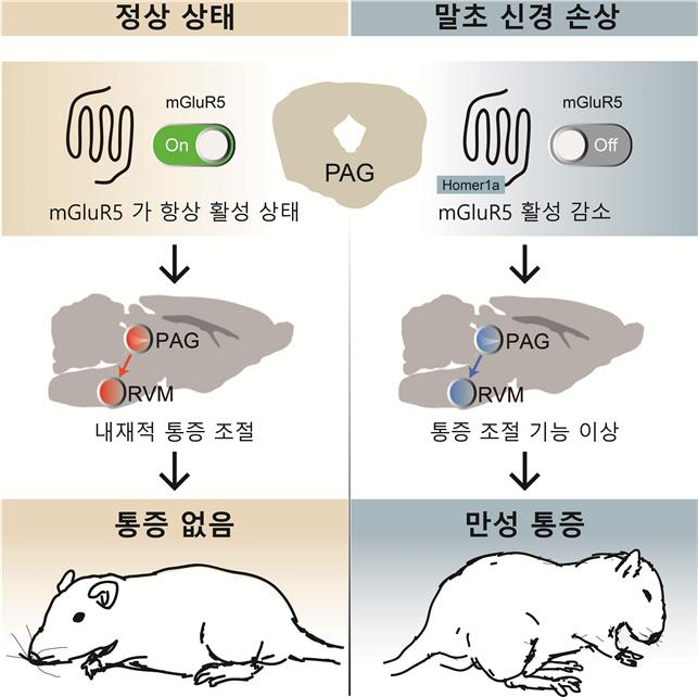 말초신경 손상 후 나타나는 신경병성 통증의 만성화.[경희대 제공]