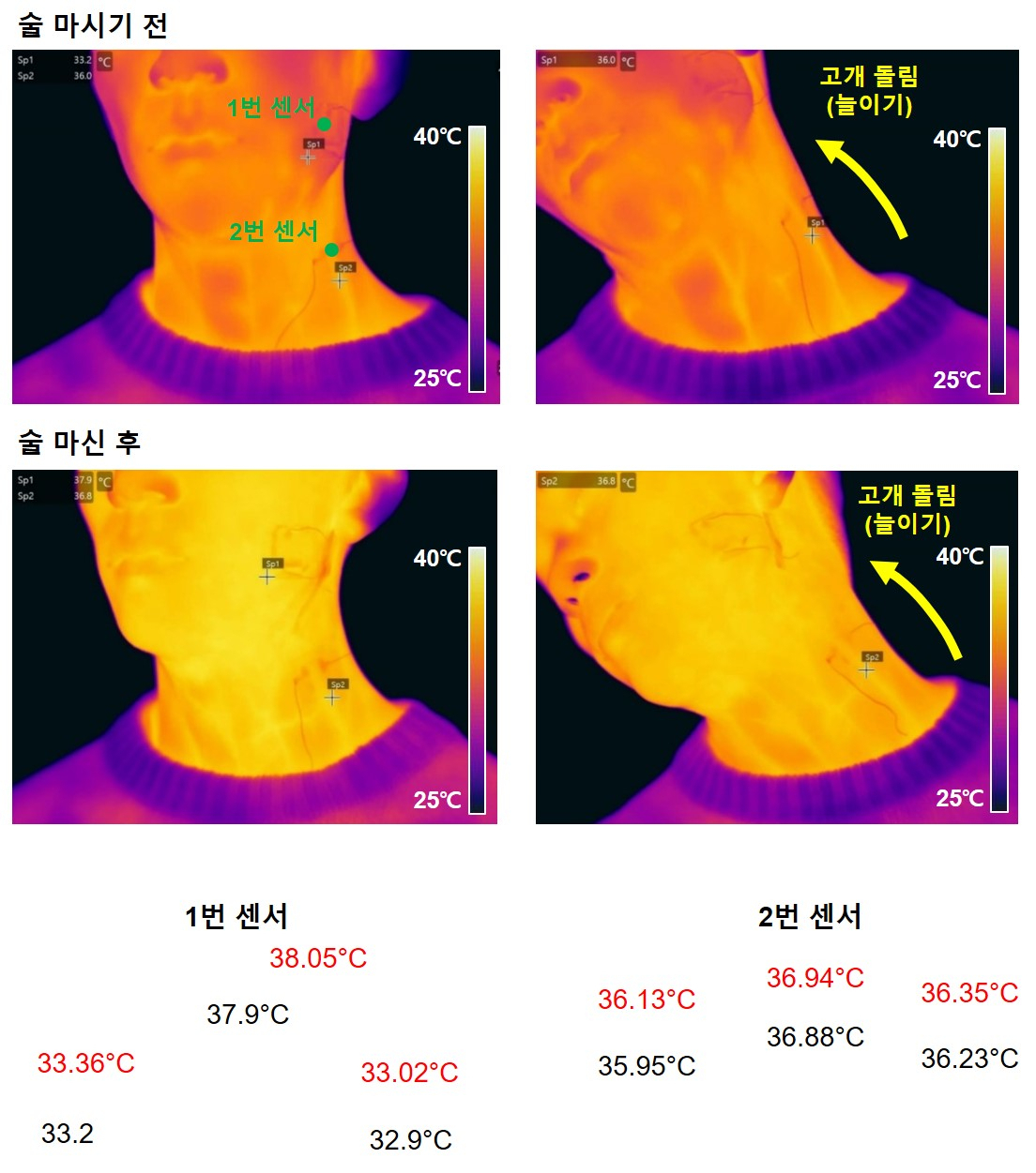 센서를 붙인 뒤 술을 마시기 전과 마신 후의 온도변화를 IR카메라로 측정했다. 목의 움직임에도 정확하게 체온을 인식한다.[포스텍 제공]