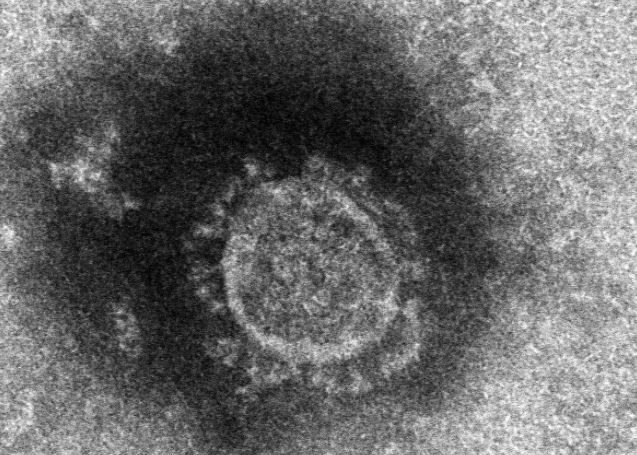 Courtesy of Japan's research institute for infectious diseases (Yonhap)