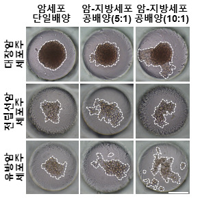 다양한 암세포(대장암, 전립선암, 유방암 세포주)를 지방세포와 함께 3차원 실리콘 칩에서 공배양(그림 가운데 및 오른쪽)하면, 암세포만 단일배양한 경우(그림 왼쪽)와 달리 암세포들이 이동하여 퍼져버리는 현상이 나타난다.[서울대 제공]