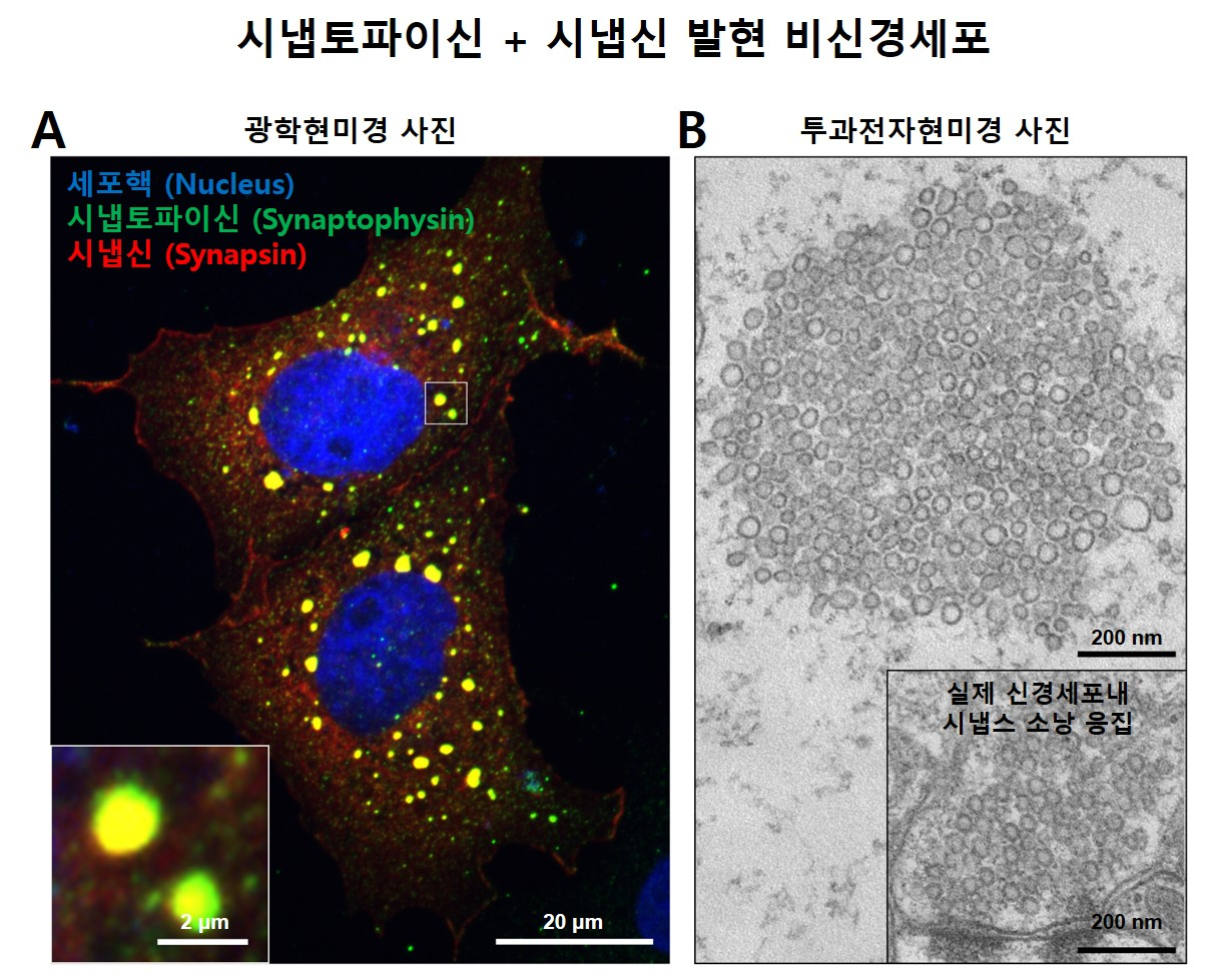 시냅토파이신과 시냅신에 의한 액체-액체 상분리 현상 및 비신경세포에서의 시냅스소낭 응집 모사 구조 형성.(A) 비신경세포에 시냅토파이신과 시냅신을 발현시킨 후 광학현미경으로 관찰한 사진(파랑: 세포핵, 초록: 시냅토파이신, 빨강: 시냅신). 세포내에서 동그랗게 뭉친 액체-액체 상분리현상을 볼 수 있다. (B) 단일 액체-액체 상분리현상을 투과전자현미경으로 본 모습. 하단의 실제 신경세포에서 관찰되는 것과 유사한 소낭들의 응집구조를 비신경세포에서 재현했다. [미국 예일대학교 제공]