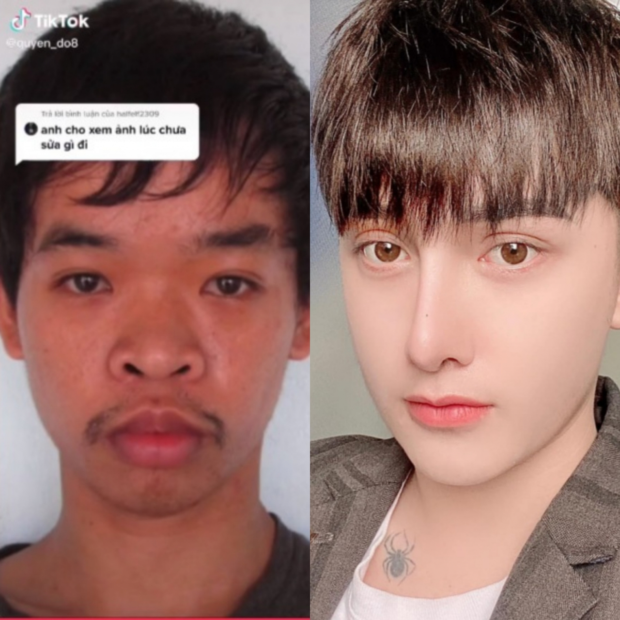 도 쿠엔의 성형 전과 후 모습 [틱톡·페이스북 캡처]