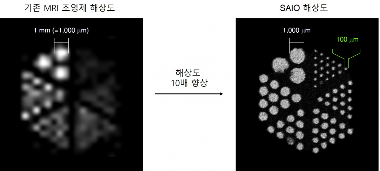 조영제 ‘SAIO(사이오)’의 크기는 5나노미터 크기로 미세혈관 직경(0.2~0.8밀리미터)보다 약 1500배 정도 작아 몸속 모든 혈관을 구석구석 돌아다닐 수 있다. 또한 뛰어난 해상도를 지녀 혈관을 최대 10배 더 자세히 볼 수 있다. [IBS 제공]