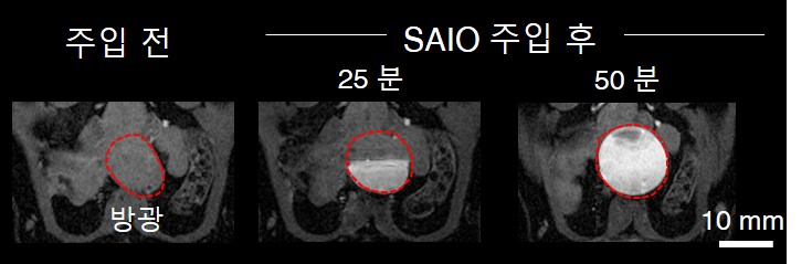 SAIO 조영제는 동물실험에서 MRI 촬영 후 소변으로 완전히 배출됐다. 실험에서는 SAIO 주입 전, 후로 쥐의 방광을 MRI로 촬영했다. 시간이 지남에 따라 SAIO가 방광으로 모이는 것을 확인했고, 방광에 모인 SAIO는 소변으로 배출됐다.[IBS 제공]