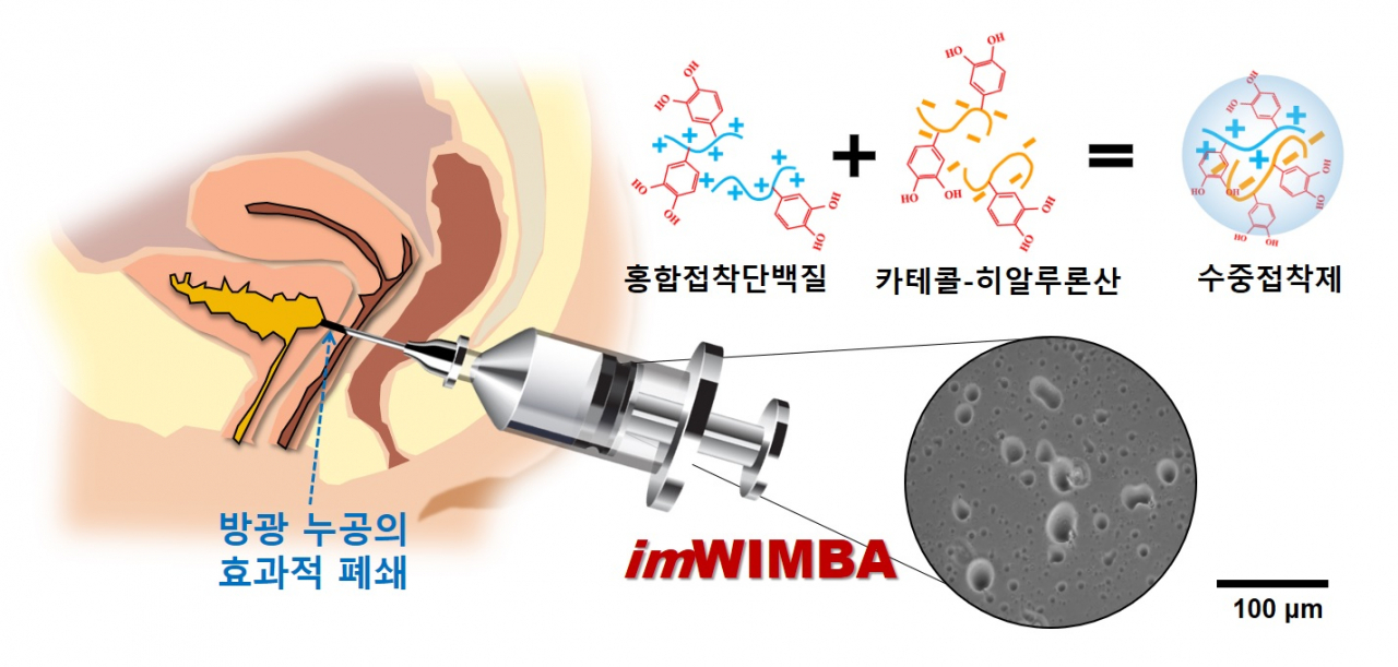 방광 누공 수중접착제 적용 모식도.[포스텍 제공]