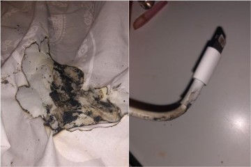 25일 애플인사이더는 지난 18일 아이폰 충전기에서 난 불이 담요에 옮겨붙어 영국 버밍엄에 거주 중인 17세 소녀가 얼굴에 화상을 입었다고 보도했다. [출처=애플인사이더]