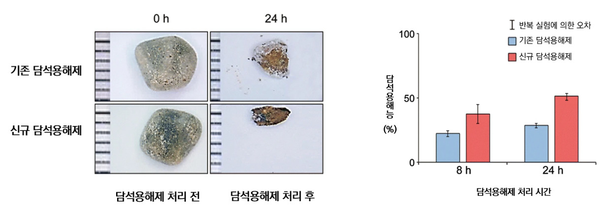 담석증 환자에게서 나온 담석으로 실험한 결과.[한국화학연구원 제공]