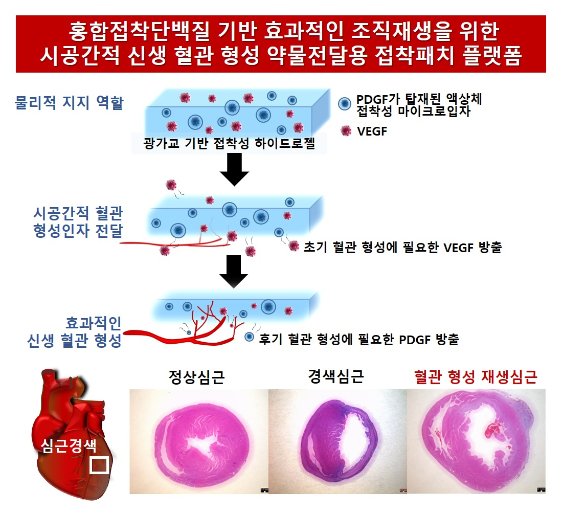 홍합단백질 기반 약물전달 접착패치 플랫폼 모식도.[포스텍 제공]