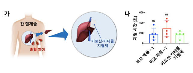 간 절제 환자 대상 임상시험에서 키토산-카테콜의 지혈효과.[KAIST 제공]