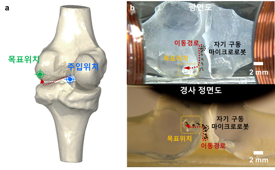 자기구동 마이크로봇의 3차원 표적화 실험. 왼쪽 그림은 마이크로로봇의 주입 위치와 목표 위치를 보여주는 무릎관절의 3차원 모델. 오른쪽 그림은 외부 자기장 제어를 통해 목표 위치로 이동하는 마이크로로봇의 시간 경과 이미지. [한국마이크로의료로봇연구원 제공]