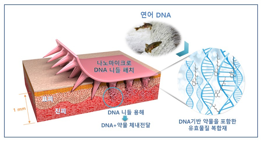 나노 마이크로 DNA 니들패치 기술 모식도.[한국기계연구원 제공]