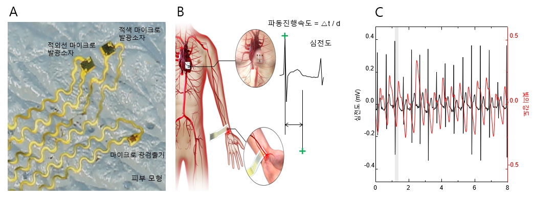 건식 전사 인쇄 기술을 적용하여 제작한 바이오센서 및 실험 사진. 연구팀이 개발한 건식 전사 인쇄 기술을 이용해 제작한 심전도 센서 사진(A)과 센서를 이용한 임상 실험의 방법 및 데이터(B,C).[DGIST 제공]