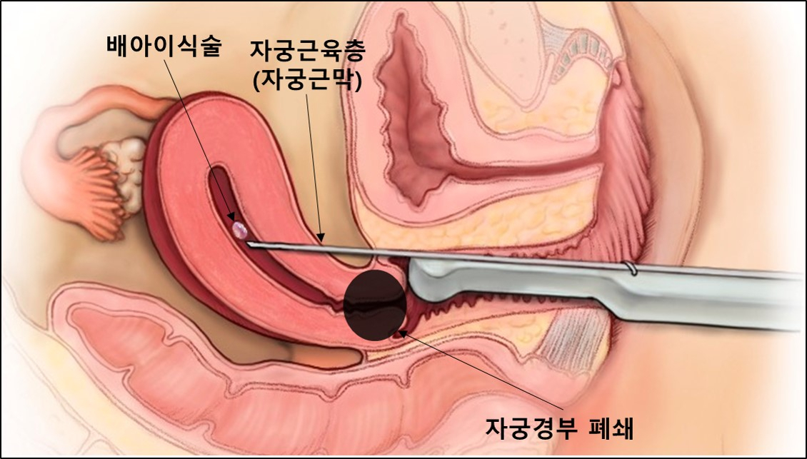 [분당서울대병원 제공]