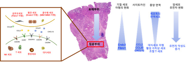 미만형 위암이 진행함에 따라 암세포들의 유전자 발현이 악성도가 증가하는 방향으로 변화, 암세포에 대항하는 종양 면역도 약화되는 것을 확인했다. 섬유모세포나 혈관세포들의 아류들도 CCL2 등의 사이토카인의 발현이 높은 아류들이 증가하는 것으로 확인돼 면역세포 및 암세포와의 상호작용에 의해 악성도 증가와 종양 면역 약화에 기여할 것으로 예측됐다.[아주대학교 제공]