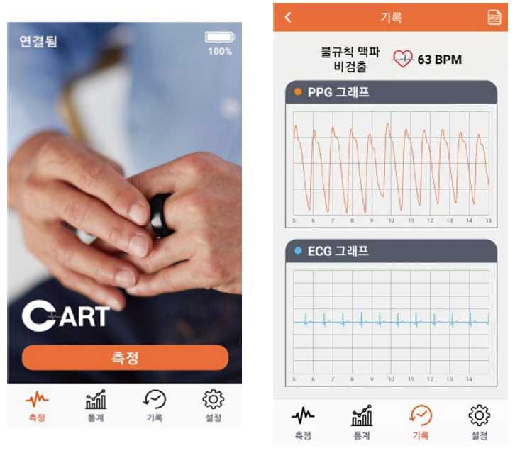 스카이랩스의 AI 기반 심장 모니터링 플랫폼 ‘카트원(CART-Ⅰ)’. [스카이랩스 제공]