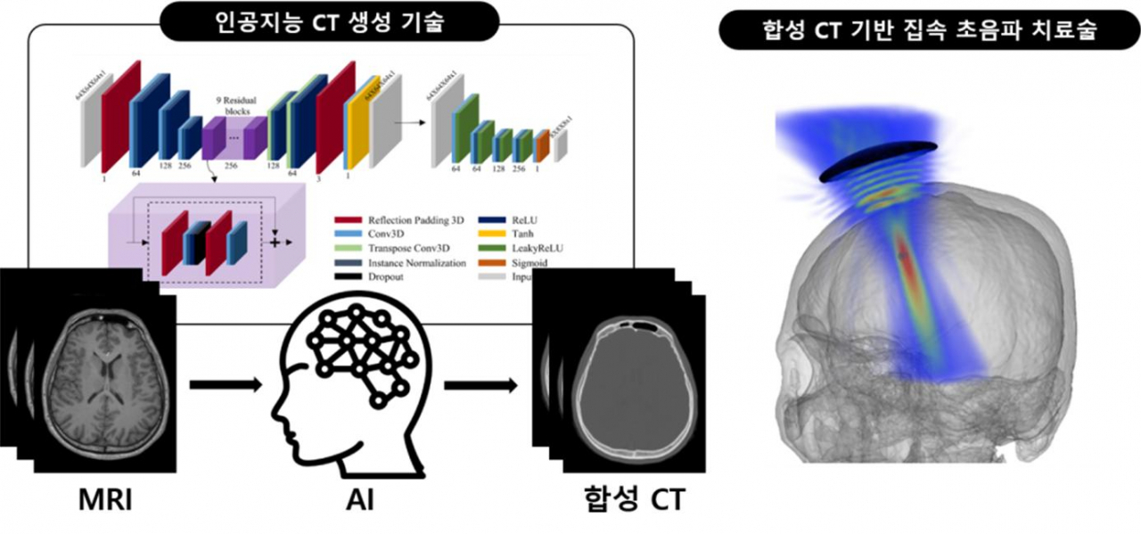 인공지능 합성 CT 기반 집속 초음파 치료술 모식도. [KIST 제공]