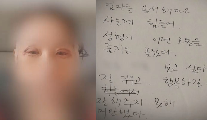 성형수술 부작용을 호소하다 유서를 남기고 극단적 선택을 한 50대 여성. [MBC 뉴스데스크 캡처]
