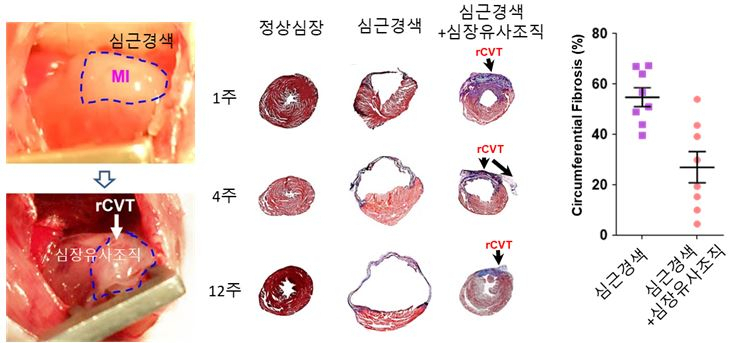 (그림2) 심장에 이식된 심장유사조직의 심근경색 치료 효과. 이식된 조직 패치에서 주요 심장 세포들이 심장 내부로 이동해 정상 심근세포처럼 기능하며 심장재생에 기여했다.
