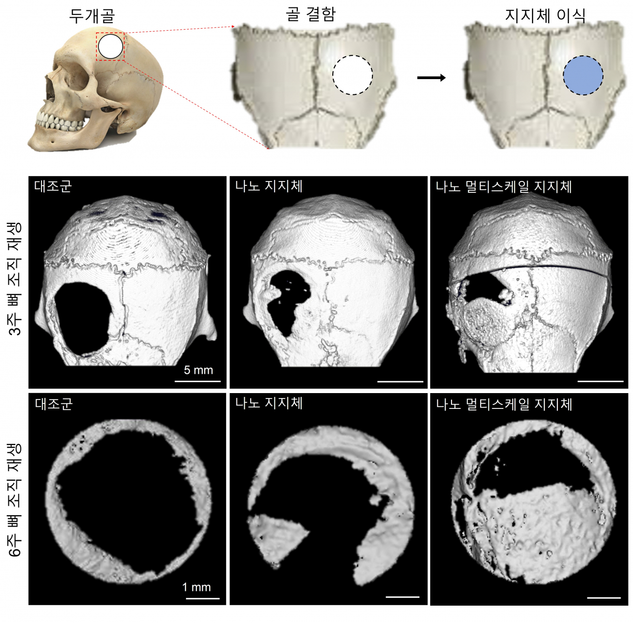 쥐 모델의 손상된 두개골 조직 위에 나노 멀티스케일 지지체를 삽입하고 3주 및 6주 후에 두개골 조직의 재생을 확인했다. 나노 멀티스케일 지지체를 이용해 재생된 뼈 조직은 대조군들에 비해 뼈 조직 형성이 촉진된다는 것을 확인할 수 있었다.[전남대학교 제공]