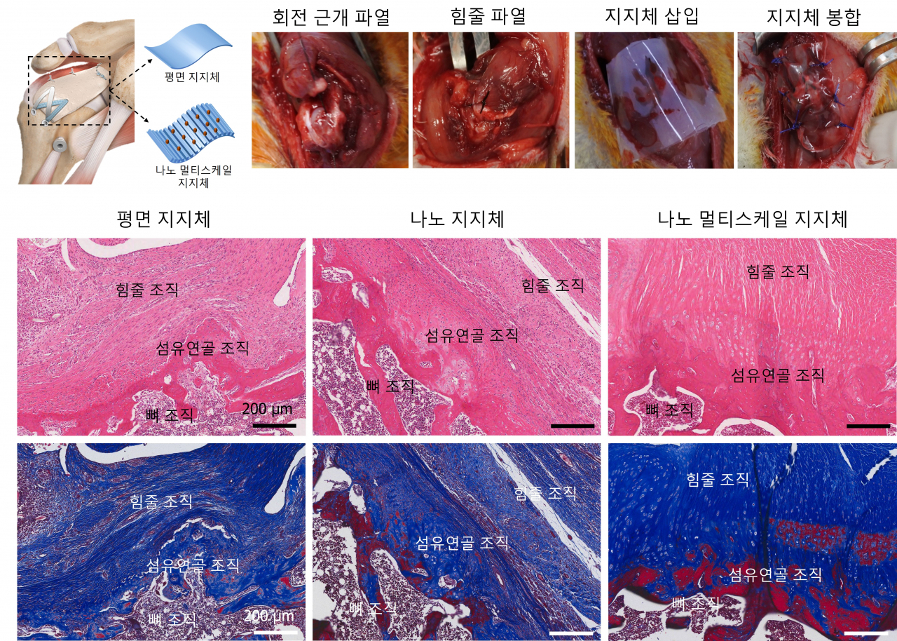 쥐 모델의 손상된 회전 근개 힘줄 조직 위에 나노 멀티스케일 지지체를 삽입, 4주 후에 힘줄 및 섬유연골 조직의 재생을 확인했다. 나노 멀티스케일 지지체를 이용해 재생된 힘줄 및 섬유연골 조직은 본래의 힘줄 조직과 유사한 콜라겐 배열과 밀도로 재생된다는 것을 증명했다.[전남대학교 제공]