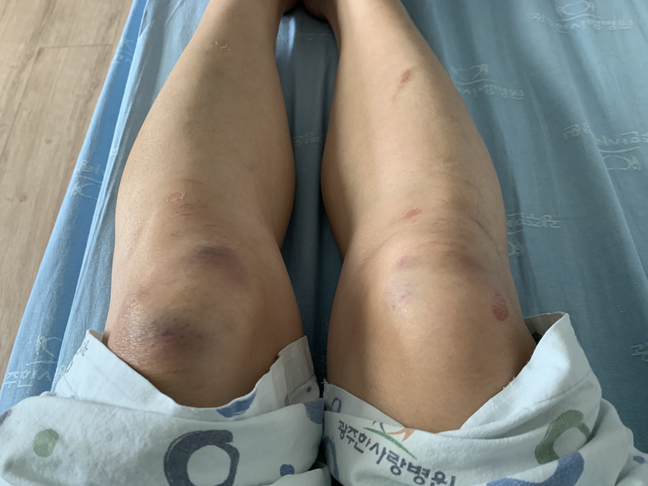 광주에서 현직 국회의원의 선거캠프에서 일한 관계자와 현직 경찰 간부가 동석한 술자리에서 여성 사업가를 일방적으로 폭행하는 사건이 발생했다. [독자 제공]