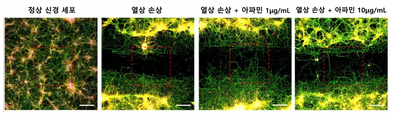 [사진설명] 고배율 현미경 관찰 상 손상을 가한 신경세포와 비교해 아파민을 처리한 신경세포에서는 아파민 농도가 높을수록 축삭돌기의 재생량과 길이가 증가했다