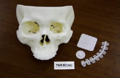 티앤알바이오펩이 3D 프린팅 기술로 만들어낸 생분해성 지지체.[티앤알바이오펩 제공]
