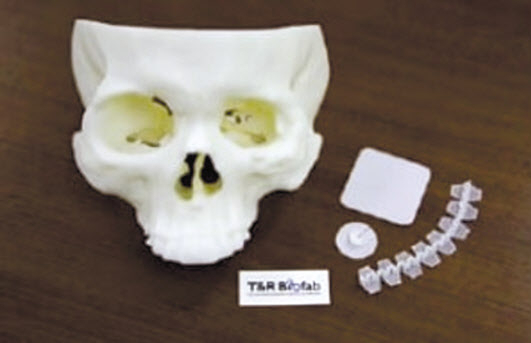 티앤알바이오펩이 3D 프린팅 기술로 만들어낸 생분해성 지지체. [티앤알바이오펩 제공]
