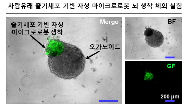 줄기세포 기반 자성 마이크로로봇의 배아 쥐 마이크로 뇌 오가노이드 생착 체외 실험.[DGIST 제공]