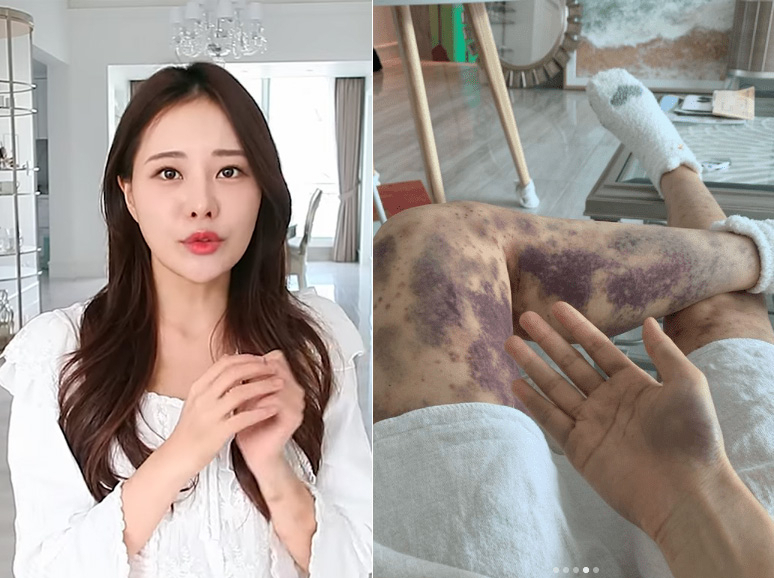 유튜버 아옳이. [아옳이 유튜브·인스타그램 캡처]