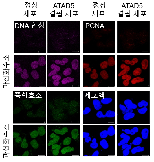 과산화수소를 처리해서 세포내 활성산소 농도를 높이면 PCNA와 DNA 중합효소의 DNA 결합 및 복구 DNA 합성이 일어난다. ATAD5 단백질 결핍 시 PCNA가 DNA에 축적되고, 복구 DNA 합성이 더욱 늘어난다. [IBS 제공]