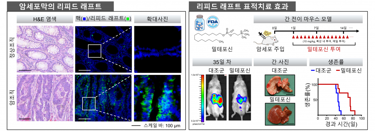 리피드 래프트 표적치료를 통한 항암치료 전략 모식도. (왼쪽) 정상조직과 암조직에서 관찰한 결과 정상세포와 비교해 암세포에 리피드 래프트가 많은 것을 확인했다. (오른쪽) 마우스(실험용 생쥐) 모델에 암세포를 주입해 밀테포신을 투여한 결과, 간 전이가 감소하고 마우스의 생존기간이 증가한 것을 확인했다.[GIST 제공]