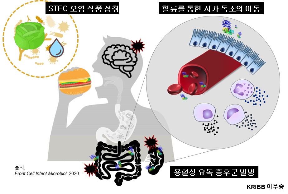 용혈성요독증후군을 유발하는 장출혈성대장균 감염과 핵심 병인 독성물질인 시가독소의 인체 장기 손상 경로.[한국생명공학연구원 제공]