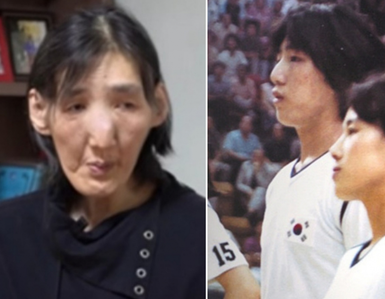 지난 11월 '근황올림픽' 유튜브 채널에서 근황이 공개된 김영희 전 농구선수. 그는 3~4년간 집밖을 안 나갔다며 2개월 동안 입원해 힘든 고비를 병원에서 넘겼다고 말했다. 오른쪽은 1980년대 농구 국가대표 시절 김영희 선수의 모습. [유튜브 캡처]