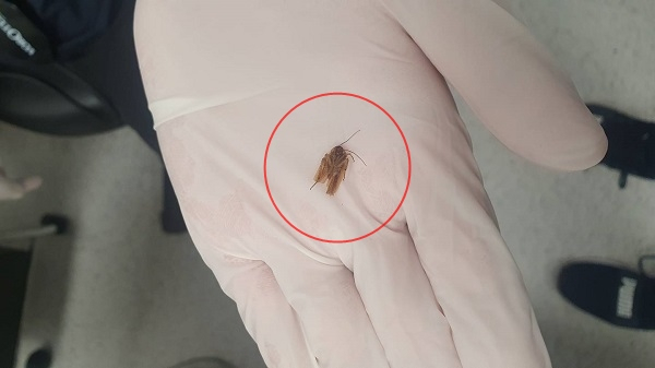 귓속에서 나온 바퀴벌레 일부분(붉은 원 안). [뉴질랜드헤럴드 사이트]