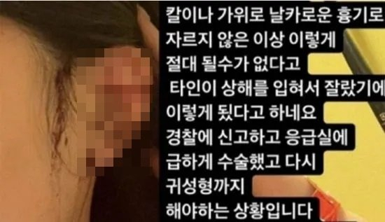 [A씨 인스타그램]