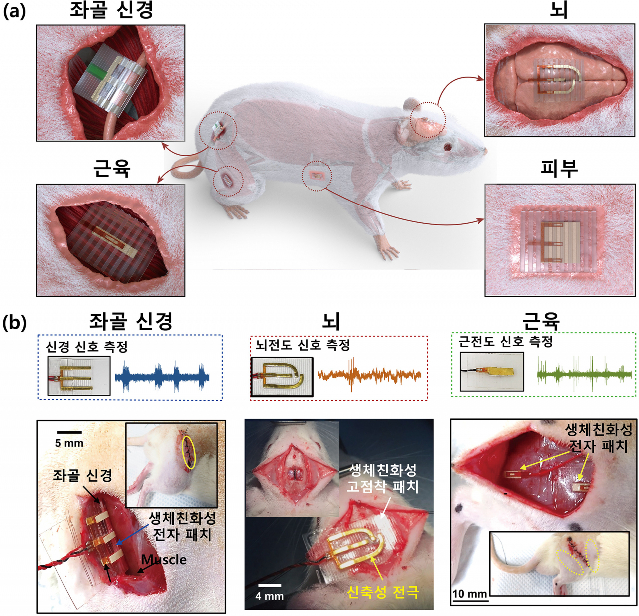 신축성 전극과 결합한 청정 접착바이오소자 개념도.[성균관대학교 제공]