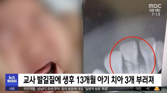 [MBC 뉴스투데이]