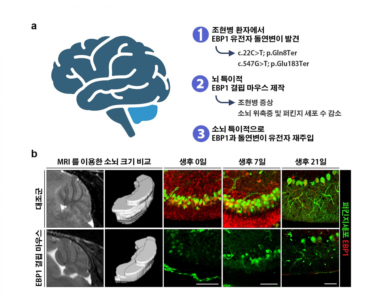 EBP1 결핍 마우스를 이용한 조현병 연구의 개념도.[성균관대학교 제공]