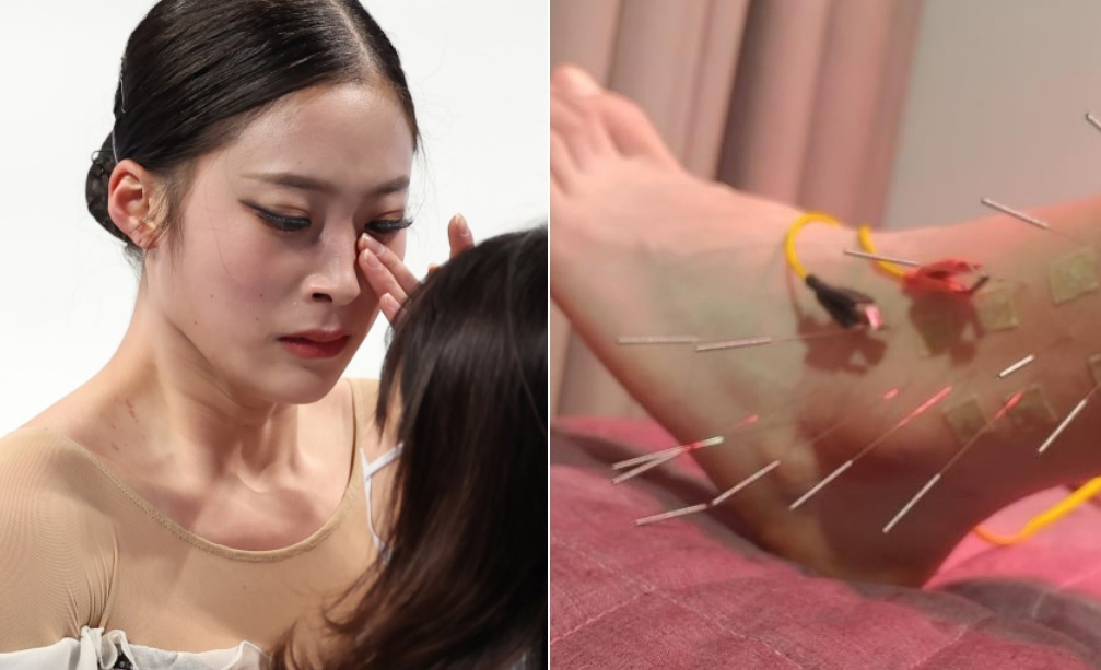 피겨스케이팅 유영(왼쪽)은 지난달 올림픽 최종 선발전을 앞두고 스케이트를 신을 수 없을 정도로 심한 발목 통증에 시달렸던 것으로 알려졌다. 사진은 심하게 부은 유영의 발목. [연합, 유영 측 관계자 제공]